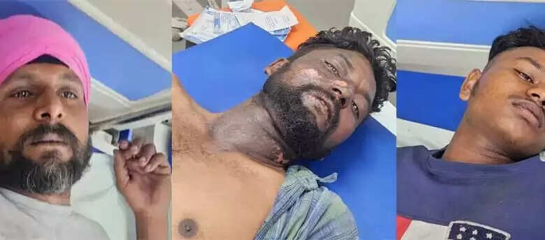 खेत में बड़ा हादसा: हार्वेस्टर चालक समेत तीन लोग 11kV तार की चपेट में आने से बुरी तरह झुलसे